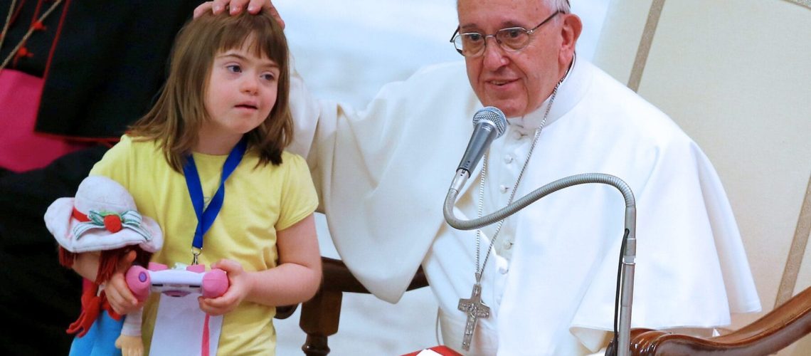 Pope Francis caresses a child as he leads a special audience during a Jubilee for the sick and disabled in Paul VI hall at the Vatican June 11, 2016. pp